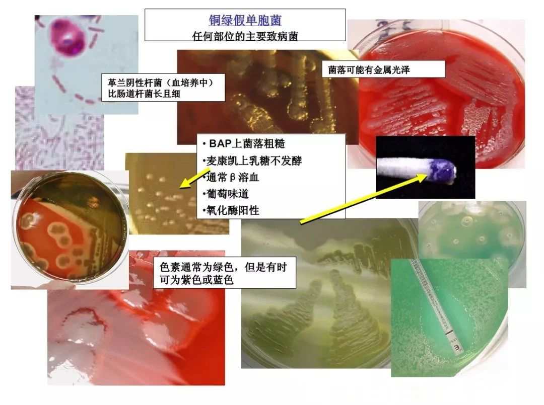 铜绿假单胞菌生化特征